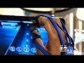 Music Glove Helps Patients With Stroke Exercises