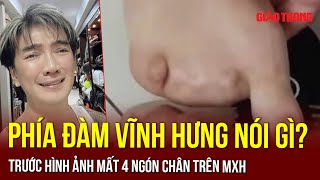 Xôn xao lộ hình ảnh bàn chân mất 4 ngón “gây sốc”, phía Đàm Vĩnh Hưng vội lên tiếng | BGT