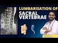 Lumbarisation of Sacral Vertebrae...Dr Sai Chandra MBBS DNB Ortho