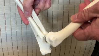 Canine elbow dislocation, reduction