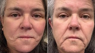 Rosie O'Donnell displays results of secret facelift as she laments 'no one has noticed' any change