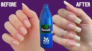 How to Whiten \u0026 Grow Your Nails Naturally At Home | 5 Home Remedies | how to grow nails fast