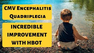 Boy with CMV Encephalitis Quadriplegia improves significantly with HBOT - Dr. Cem KINACI