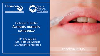 Implantes 3: Sebbin - Aumento mamario compuesto I Dres. Auclair, Kerfant \u0026 Dr. Alejandro Marchac