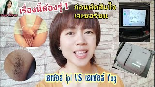 เรื่องนี้ต้องรู้ ก่อนที่จะตัดสินใจ เลเซอร์ขน เลเซอร์ขนรักแร้ เลเซอร์น้อง | Rose Travel รีวิว