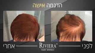 פתרון לשיער דליל ודק עם ריביירה