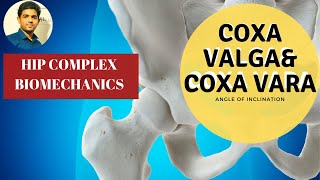 Angle of Inclination |Coxa Valga | Coxa Vara- (Hip Biomechanics)