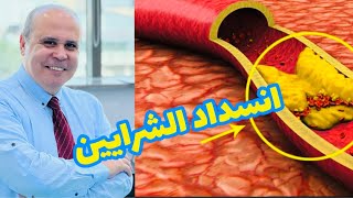 انسداد شرايين القلب وعلامات الخطوره لمرضي السكر والقلب👈طرق طبيعيه للعلاج