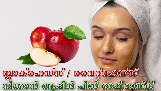 Apple Peel-Off Mask For Glowing Face | ആപ്പിൾ പീൽ ഓഫ് മാസ്ക് ഉപയോഗിച്ചാലുള്ള ഗുണങ്ങൾ