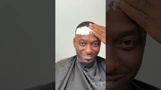 $100 Hairline Fix 💈😫 Pt 1 #hairline #barber