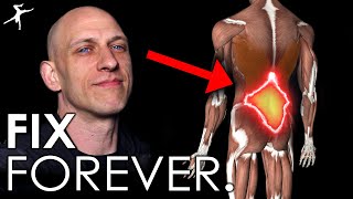 How to Fix Low Back Pain (FOREVER).