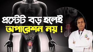 প্রস্টেট গ্রন্থির চিকিৎসা মানেই অপারেশন নয়। অধ্যাপক ডাঃ সোহরাব হোসেন সৌরভ। হাসপাতাল