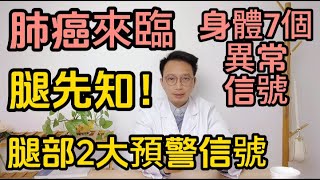 肺癌來臨腿先知！醫生提醒：儅腿部出現這2大信號，身體出現這7種異常信號時，建議立刻進行CT檢查！可能是肺部出現問題了