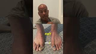 David Goggins' FEET After 23 YEARS Of RUNNING😳