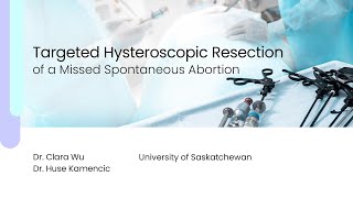 Targeted Hysteroscopic Resection of a Missed Spontaneous Abortion