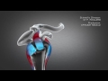 Standard or reverse shoulder replacement