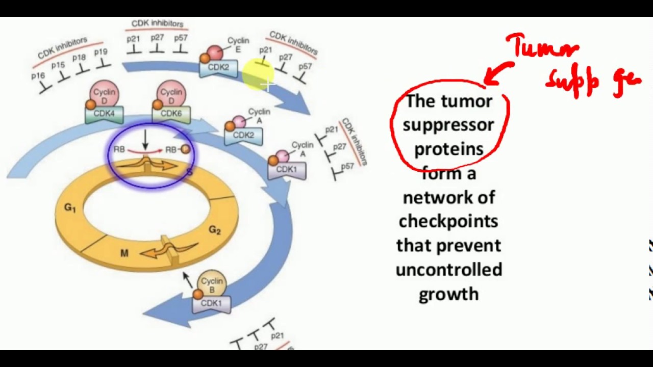 Pathology Lectures Neoplasia Part 4 Youtube