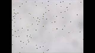Sorting Algae Cells