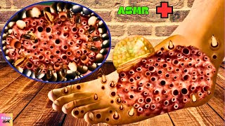 LIVE | HEAVY INFECTED  ASMR TREATMENT | REMOVE TRYPOPHOBIA ANIMATION  @relaxoasmrofficial