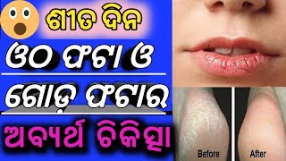 ଶୀତ ଦିନ ଓଠ ଫଟା/ଗୋଡ଼ ଫଟାର ଅବ୍ୟର୍ଥ ଚିକିତ୍ସା | Remedy for Cracked lips/heels