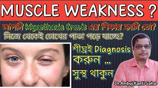 Myasthenia Gravis - symptoms, pathophysiology, investigations, treatment in Bengali | Home remedies