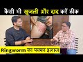 Ringworm Fungal Infection Ft. @ShreeRadhey | Daad khaj khujli ka ilaj | Himanshu Bhatt