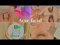 Professional Acne Facial Tutorial I Best For Blackheads, Acne Scars & Spots, Oily Skin I HINDI