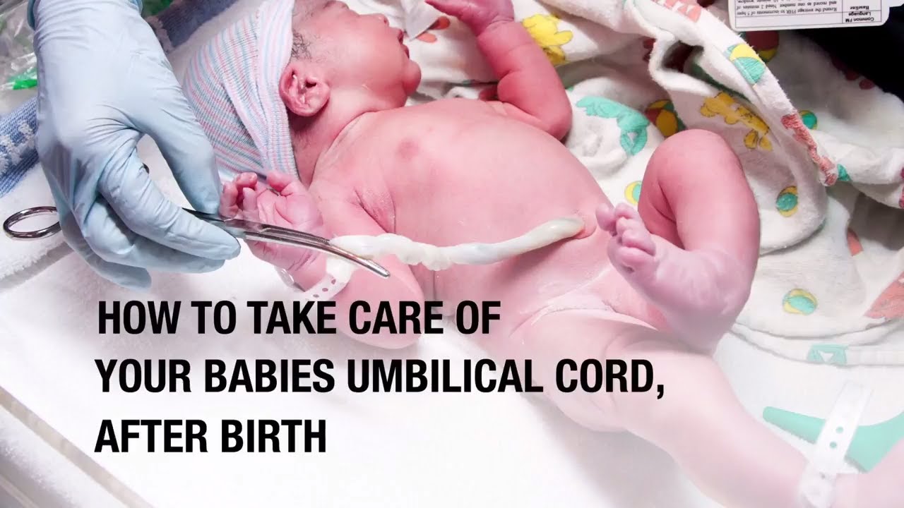 How To Take Care Of Your Babies Umbilical Cord, After Birth - YouTube