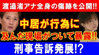 渡邉渚アナ全身の傷跡を公開!!中居が行為に及んだ現場がついて暴露!!刑事告訴発展!?