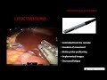 prof. pier c. giulianotti robotic hpb surgery