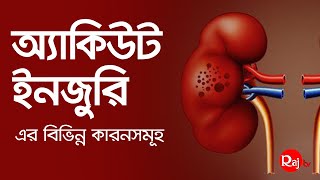 অ্যাকিউট কিডনি ইনজুরি এর বিভিন্ন কারনসমূহ | causes of acute kidney injury | kidney health tips