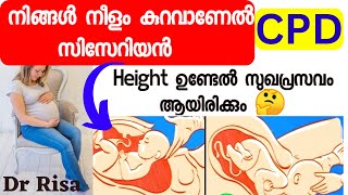 Reason For Cesarean Malayalam|CPD In Pregnancy| Height Affect Delivery