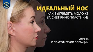 Ринопластика в Корее |  Отзыв о пластической операции