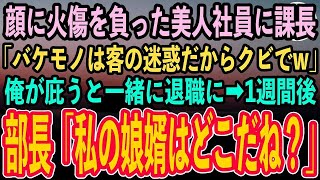 【感動する話】火事で顔に火傷を負った美人社員に課長「バケモノは客の迷惑だからクビ」俺が庇うと一緒に退職させられた…→1週間後、海外出張から帰社した部長「私の娘婿はどこだ？」課長は顔面蒼白に