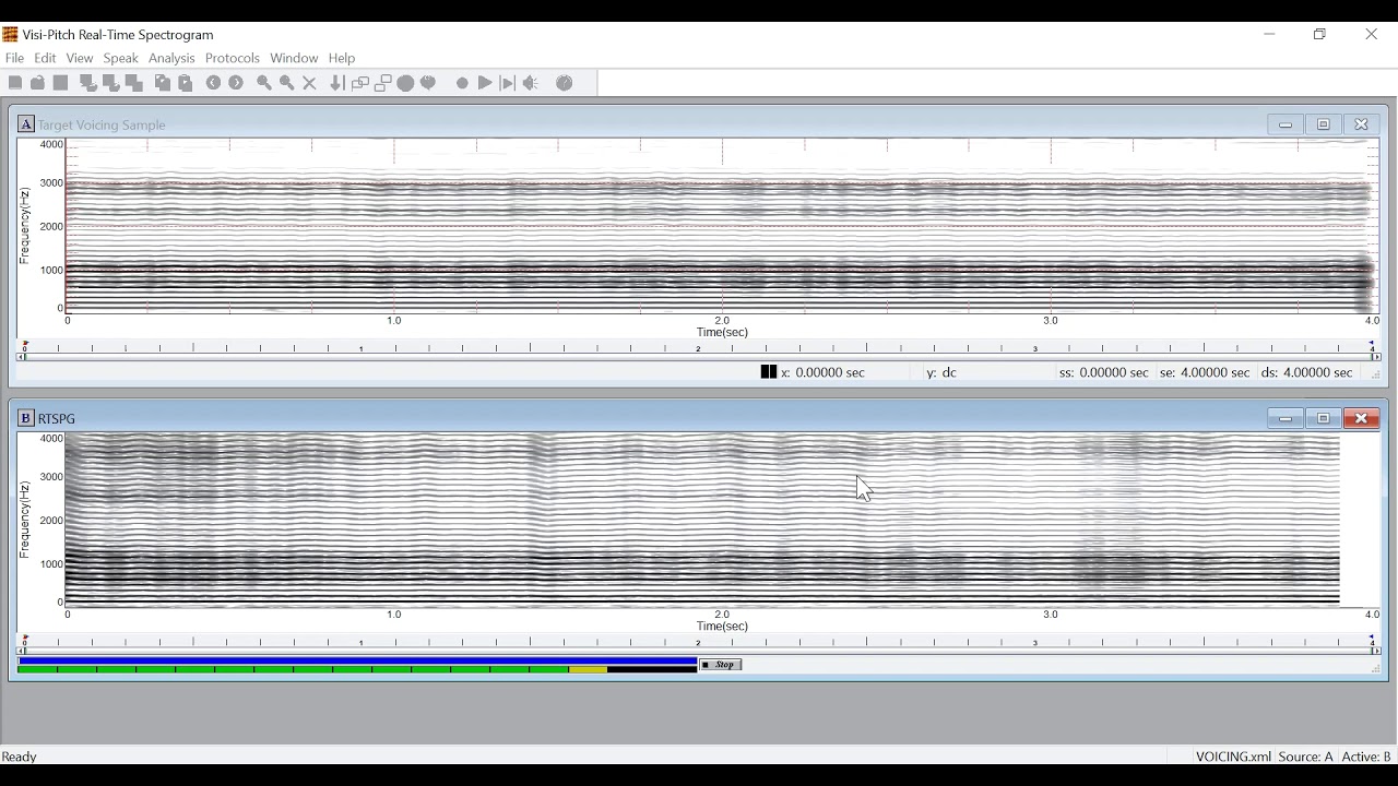 Visi-Pitch, Model 3950c: Real-Time Spectrogram (RTSPG) Tutorial - YouTube