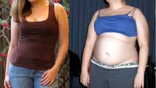 HUGE Weight Gain of 70 LBS - Before \u0026 After