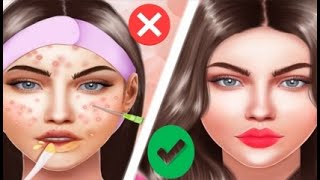 ASMR Big Acne Remove Deep cleansing  Infested Face Removel Severely Injured Animation Cartoon