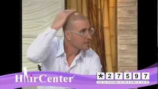 טיפול בהתקרחות שיער לגבר תל אביב במרכז הדמיית שיער