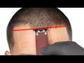 How To Line Up A Bad Hairline