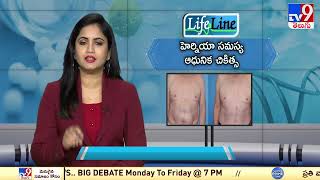 Life Line : హెర్నియా సమస్య ఆధునిక చికిత్స | Modern Treatment of Hernia Problem - TV9