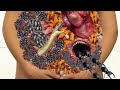 belly insect &maggot removal asmr.Best relaxing and deep cleaning.2D animation@bkasmr2.0@bkasmr2.0