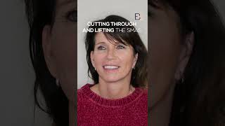 Full Facelift (Rhytidectomy) with Neck Plication Before and After (Patient 2018-10000) #shorts