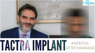 Tactra Penile Implant | happy patient 4 months after marriage!!
