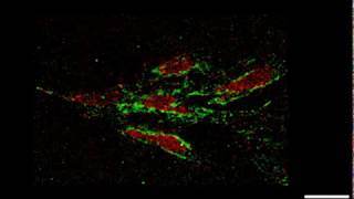 iPSC focal adhesions