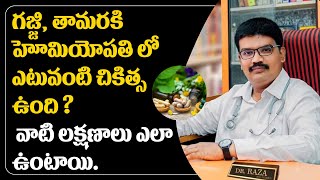 గజ్జి,తామర అంటే ఏంటి ?వీటికి హోమియోపతిలో ఎటువంటి చికిత్స ఉంది?వాటి లక్షణాలు ఎలా ఉంటాయి|| Varahi News