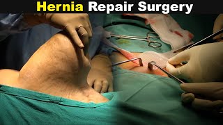How Hernia Surgery Is Performed? | Hernia Repair (Urdu/Hindi)