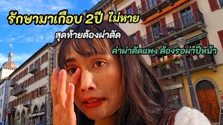 มาแจ้งข่าว เตรียมตัว ผ่าตัด ตา ในปีหน้า | รักษามาอย่างยาวนานไม่หายซ่ะที เลยตัดสินใจผ่าตัด |