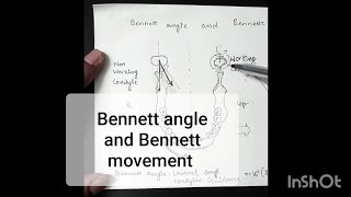 Bennett angle and Bennett movement | Mandibular movements