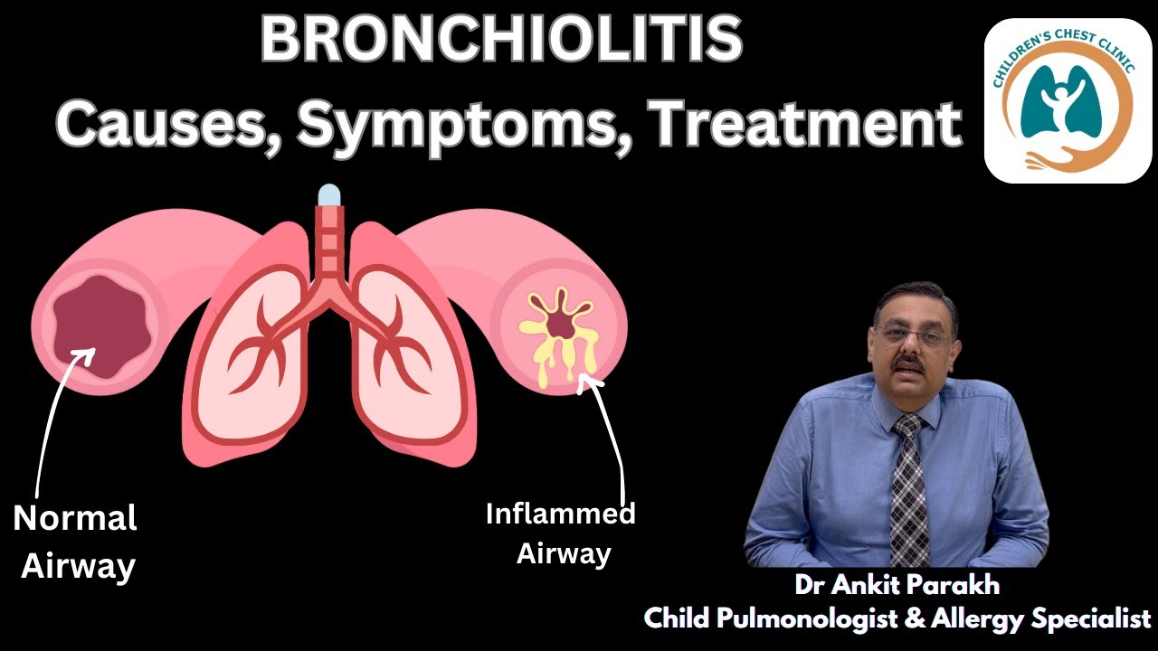 Bronchiolitis In Children: Causes, Symptoms, Treatment I Dr Ankit ...