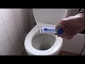 How to collect a poop sample | Collecting a stool sample | faeces sample collection | FIT kit